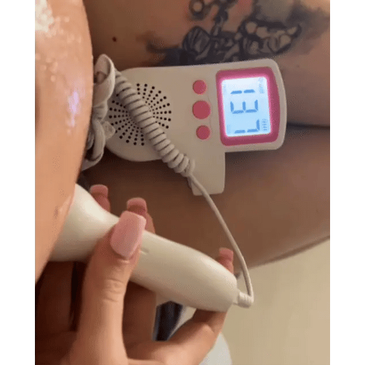 BebeBeat™ PRO – Monitor Fetal cu Difuzor Integrat pentru Ascultarea Bătăilor Inimii Bebelușului Acasă (12+ Săptămâni)