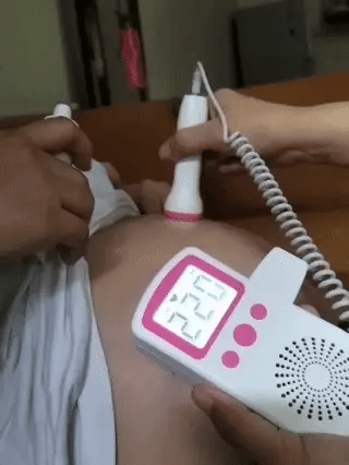 Dumpling Squishy™ – Jucăria Virală pe care Copiii o Adoră